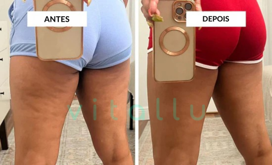 Adeus celulite e flacidez! Resultados visíveis em poucas semanas – transforme sua pele agora mesmo!